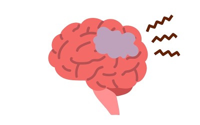 Medical illustration of cross section of brain