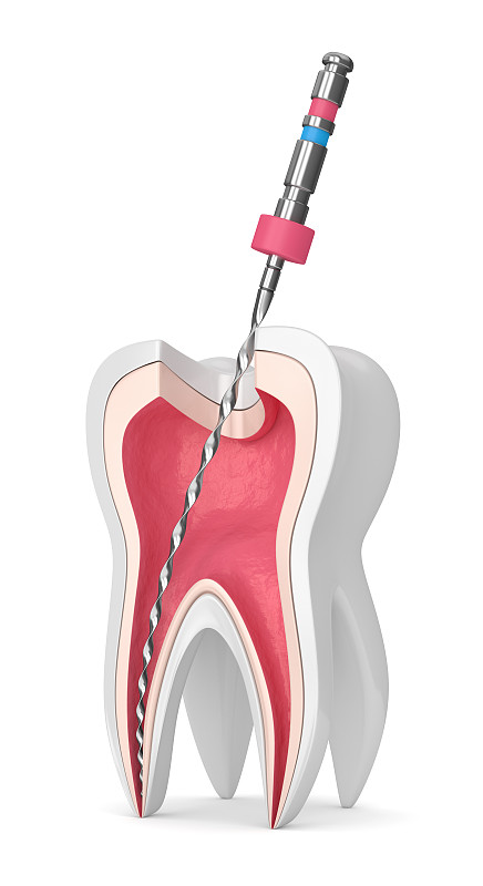 3d渲染的牙齿与根管锉