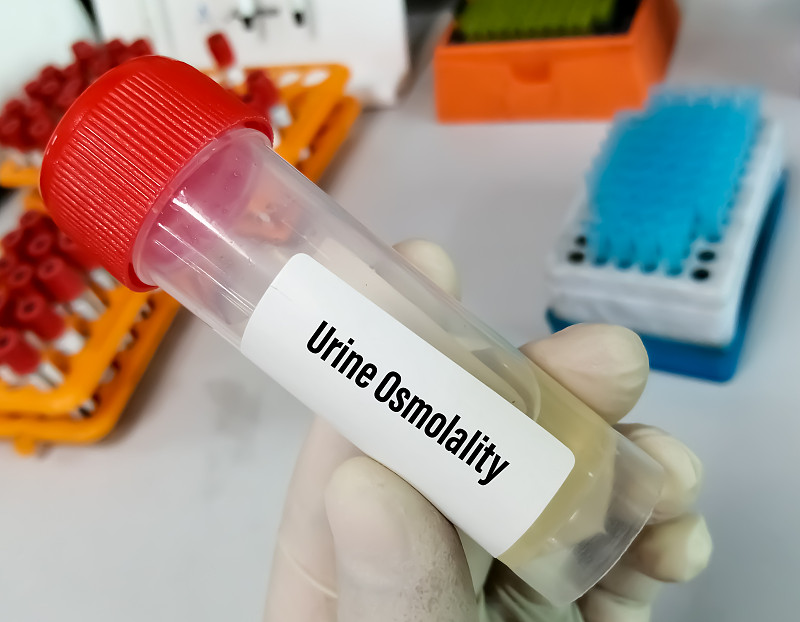 科学家手持尿液容器进行尿液渗透性测试。