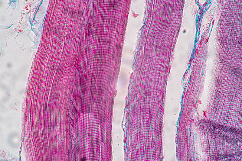 显微镜下哺乳动物组织的横纹(骨骼)肌肉。