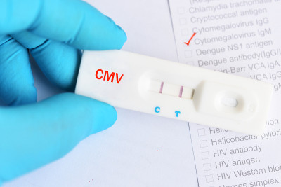 巨细胞病毒(CMV)检测阳性