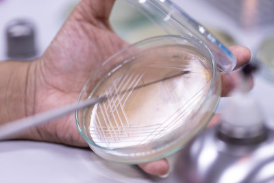 教育用培养皿中酵母菌落特性研究。