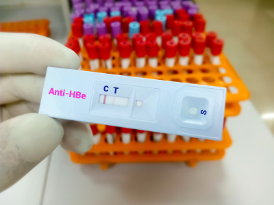 抗hbe快速测试盒。HBeAb