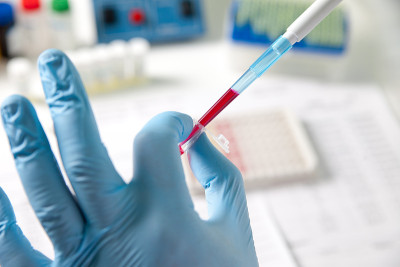 科学实验室的技术员拿着一管血液