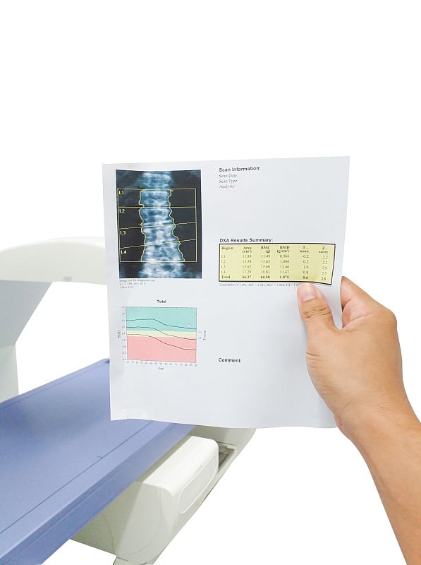 特殊检查手医生检查结果脊柱骨密度。太模糊和人工成像，