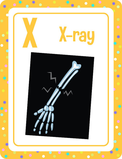 用字母X表示X射线的字母卡片