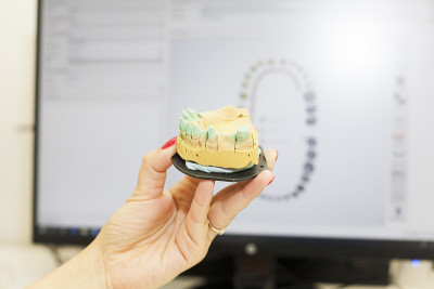 比较3d牙科扫描和牙科假体模具