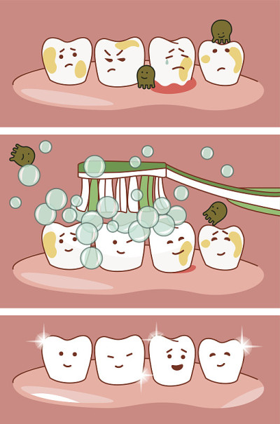 清洁牙齿的插图牙刷