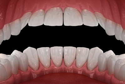 正常咬合的健康人类牙齿，内观形态。医学上准确的牙齿3D插图