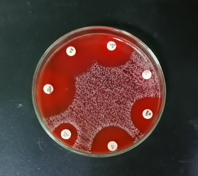 在菌落中显示抗生素敏感性的细菌生长培养板。抗生素敏感性。