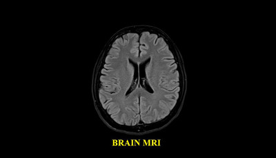 健康男性大脑MRI扫描(磁共振成像)高分辨率