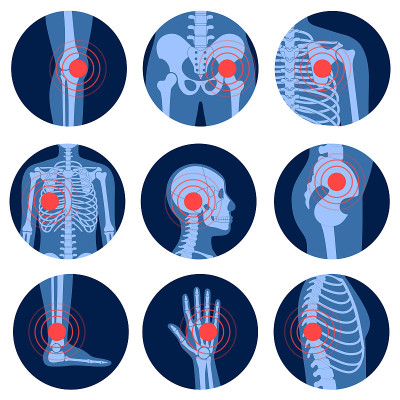 Pain4_Skeleton