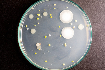 微生物实验室教育用土壤样品中细菌和霉菌在琼脂平板上生长的特点和不同形状菌落的背景。