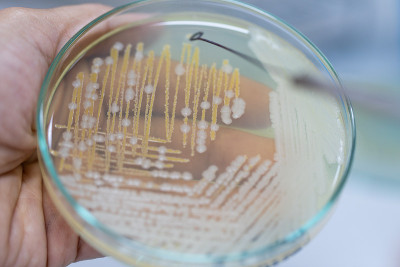 教育用培养皿中酵母菌落特性研究。