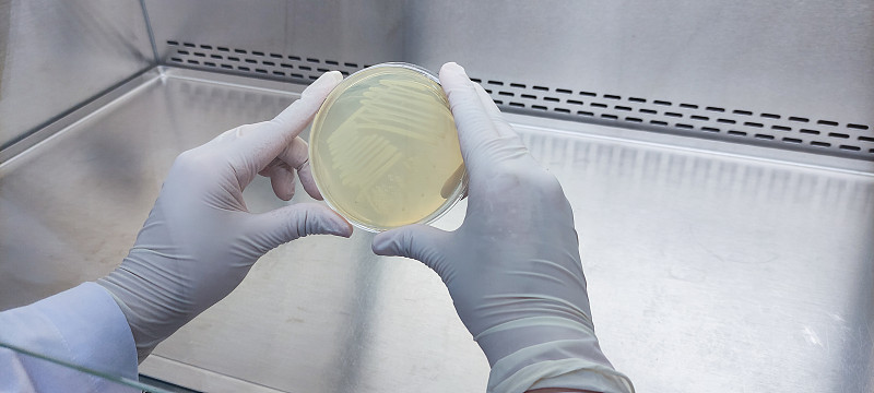 科学家在微生物实验室检查培养皿试验的剪影。