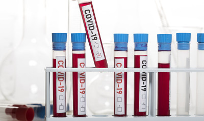 被冠状病毒污染的生物样本管，标签为Covid-19
