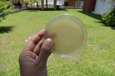 培养皿中琼脂培养基进行微生物板计数