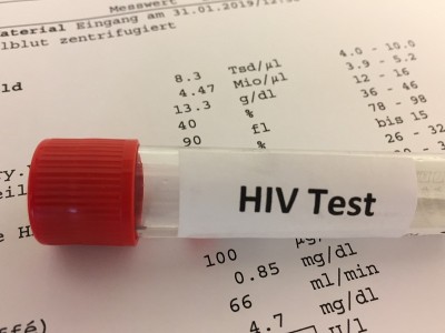 HIV实验室检测用试管