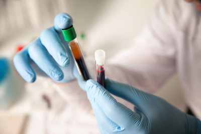 科学实验室的技术员拿着一管血液