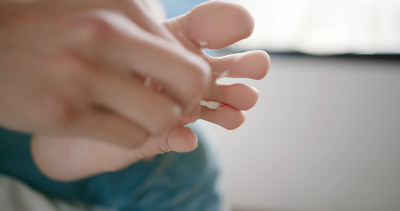 涂抹运动员足霜