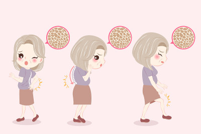 有更年期问题的女性