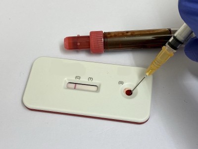 肌钙蛋白I即时测试