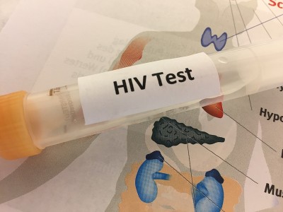 HIV实验室检测用试管