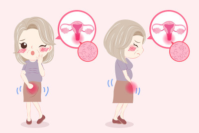 有更年期问题的女性