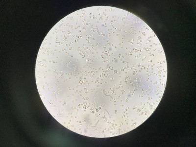 适量新鲜红细胞和白细胞。