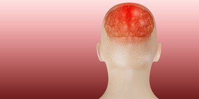 头痛的大脑系统问题头盖骨疼痛脸人显示头痛的3d插图