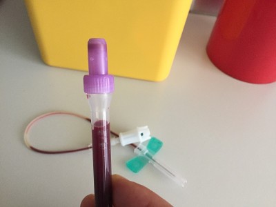 背景中有人血蝴蝶针的试管