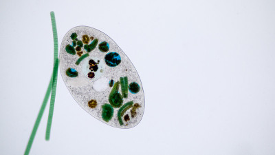 在显微镜下，Frontonia sp.是一种自由生活的单细胞纤毛虫原生生物。