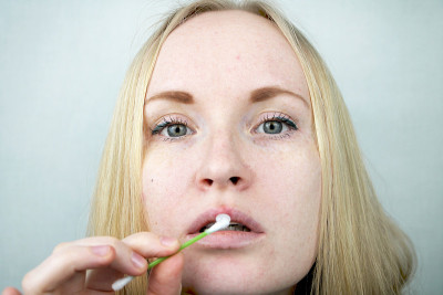 美丽的年轻女子，嘴唇感染了疱疹病毒。疱疹病毒治疗的概念
