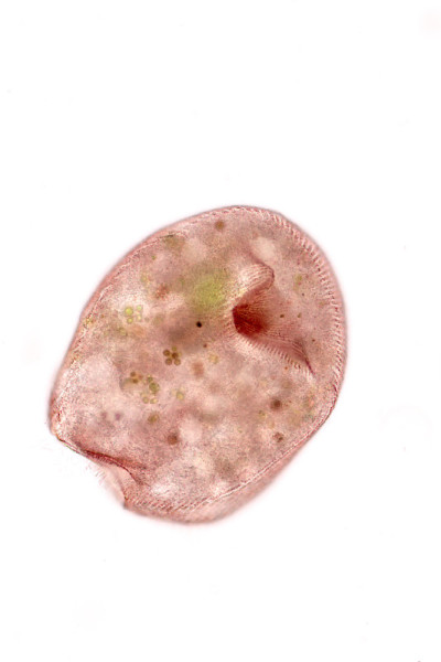 Stentor，有时被称为喇叭微生物，是一种滤食性异养纤毛虫属，是显微镜下废水中异养生物的代表。
