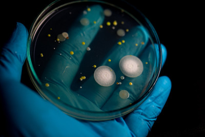 微生物实验室教育用土壤样品中细菌和霉菌在琼脂平板上生长的特点和不同形状菌落的背景。