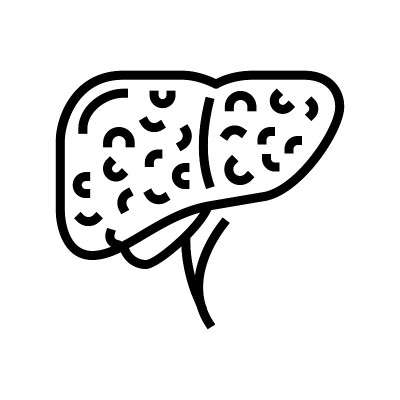 肝硬化病线图标矢量插图