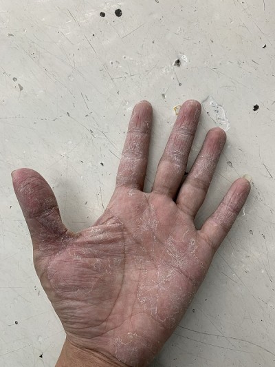 去皮的手