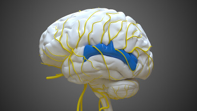医学概念3D右上颞回脑后部解剖