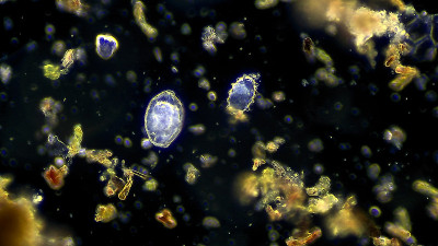 微生物-纤毛虫草履虫