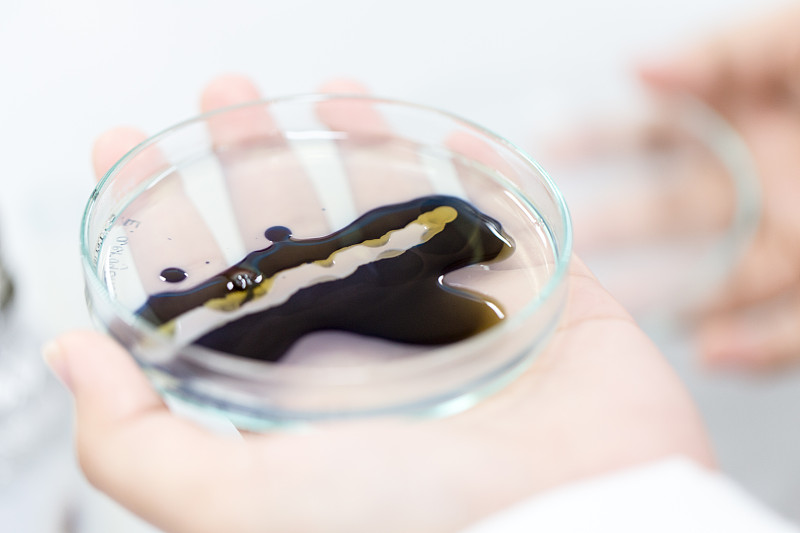 实验室用碘检测感染微生物。