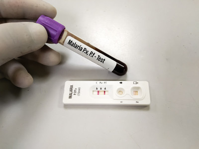 疟疾寄生虫间日疟原虫和恶性疟原虫血液样管和快速检测盒。