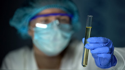 实验室工作人员拿着装有尿样的试管，进行健康检查，医学分析