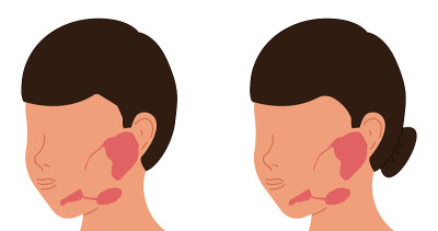 男性和女性的唾液腺定位。医疗矢量插图。