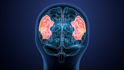 人脑交叉解剖学的三维渲染