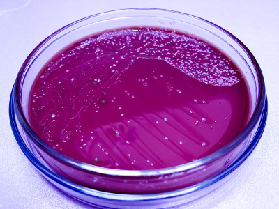 巧克力琼脂培养基在医学微生物实验室培养肺炎链球菌、金黄色葡萄球菌。