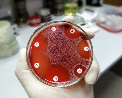 手握培养板的细菌生长显示抗生素敏感性的菌落