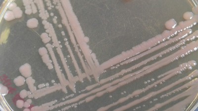 培养皿，琼脂上有各种菌落