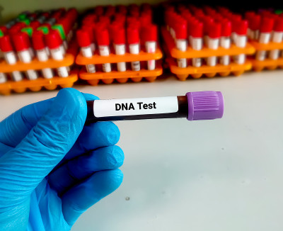 DNA测试。医生/科学家在实验室拿着用于DNA测试的血样采集管。