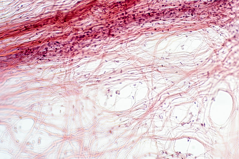 镜下为网状结缔组织。人类生理学的组织学。