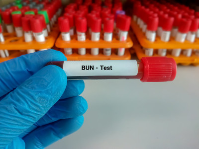 血液尿素氮(BUN)检测。肾脏或肾脏疾病的诊断